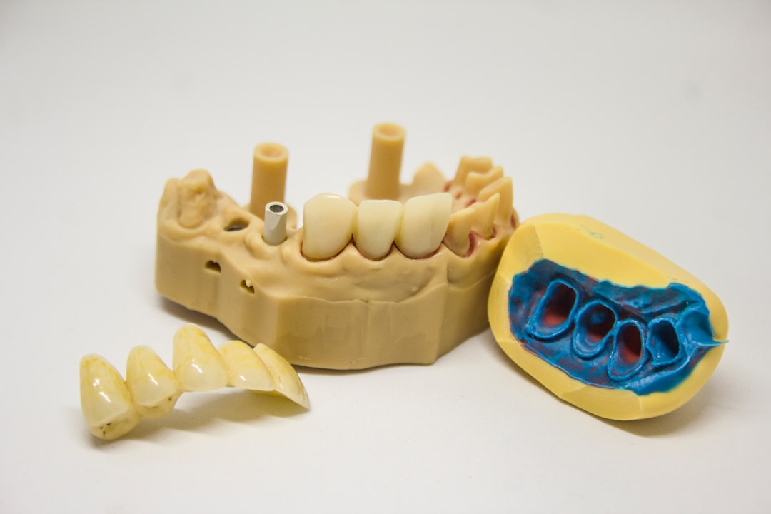 DIY Tooth Repair Kit: A Quick Fix for Dental Emergencies
